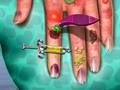 Permainan Dokter Kulit Tangan secara online