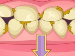 Permainan Bad Teeth Makeover secara online