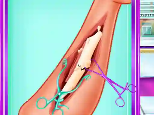 Permainan Ladybug Leg Surgery secara online