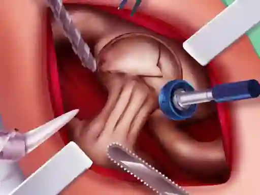 Permainan Princess Hips Surgery secara online